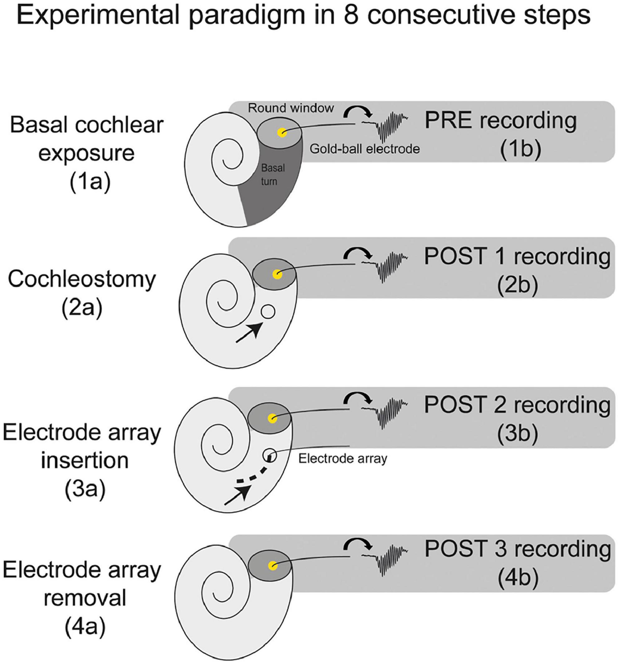 Acute effects of cochleostomy and electrode-array insertion on compound action potentials in normal-hearing guinea pigs
